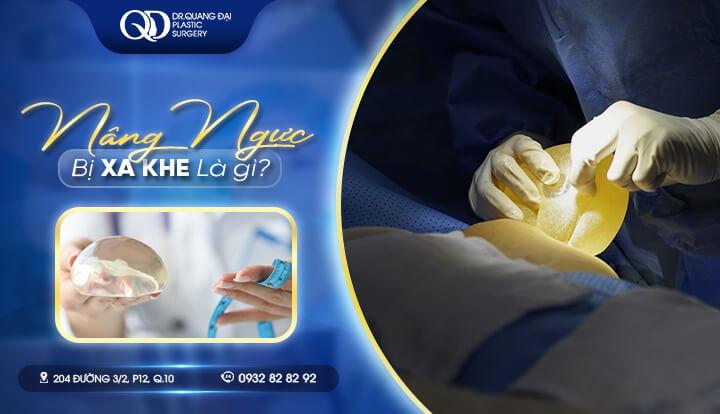 Nâng Ngực Bị Xa Khe: Nguyên nhân và Cách khắc phục hiệu quả